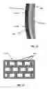 Fig. 07 - Method of manufacture of custom cranial remodeling devices by additive manufacturing