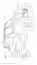 Fig. 02 - Leading-edge steering assembly