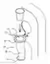 Fig. 01 - HYGIENE ACCESSORY FOR A PASSENGER SEAT AND METHOD FOR MAINTAINING A PASSENGER-TRANSPORT DEVICE