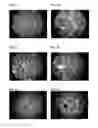 Fig. 02 - SINTERED SPHERES, PROCESS FOR THEIR PRODUCTION AND USE THEREOF