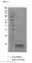 Fig. 02 - Insulin analogs and use thereof