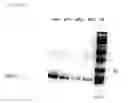 Fig. 28 - AGENTS FOR REDUCING THE ACTIVITY OF GDF15