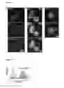 Fig. 09 - METHOD AND CULTURE MEDIUM FOR EX VIVO CULTURING OF EPIDERMIS-DERIVED STEM CELLS