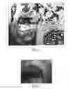 Fig. 08 - Hormone responsive tissue culture system and uses thereof