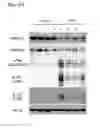 Fig. 06 - PHARMACEUTICAL COMPOSITION FOR NEURODEGENERATIVE BRAIN DISEASE AND SCREENING METHOD FOR THE SAME