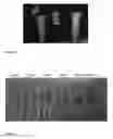 Fig. 02 - Kit and methods for the rapid detection of the absence or presence of a β-lactamase in samples of body fluids