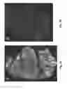 Fig. 06 - DNA-antigen exchange and amplification