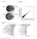 Fig. 09 - A METHOD FOR DIAGNOSING A DISEASE BY DETECTION OF circRNA IN BODILY FLUIDS