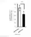 Fig. 02 - Methods for determining the metabolic status of lymphomas