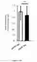 Fig. 03 - Methods for determining the metabolic status of lymphomas