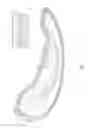 Fig. 04 - Balanced crimp substrate reinforcement for molded products