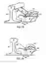 Fig. 08 - Boltless rail brace