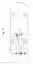 Fig. 10 - Offshore structure, supporting member, skid shoe, method for moving a cantilever