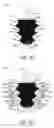 Fig. 10 - Tools and methods for cleaning grooves of a turbine rotor disc