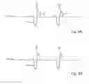 Fig. 04 - Ignition coil boost at low RPM