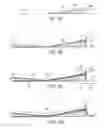 Fig. 05 - Reinforcing structure for a wind turbine blade