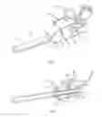 Fig. 02 - Energy absorbing device