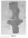 Fig. 08 - Wireform clip for use with supply valves