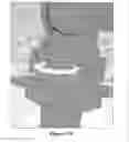 Fig. 17 - Wireform clip for use with supply valves