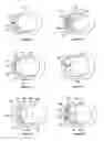 Fig. 02 - Variations of fluid opening geometry for rotary valve body