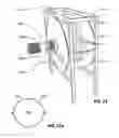 Fig. 22 - Heat exchanger for use in cooling liquids