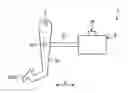 Fig. 01 - PEDAL OPERATION DETECTING DEVICE