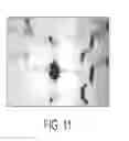 Fig. 12 - Device and methods of using device for detection of hyperammonemia