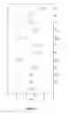 Fig. 05 - Method for identifying a compound useful in mitigating and/or the treatment of a disease associated with abnormal astrocytic function