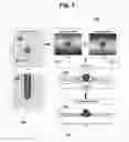 Fig. 02 - Passive MRI-guided tracking of metallic objects using artifact-reduced imaging with selective excitation