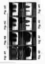 Fig. 05 - Passive MRI-guided tracking of metallic objects using artifact-reduced imaging with selective excitation