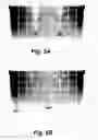 Fig. 06 - Passive MRI-guided tracking of metallic objects using artifact-reduced imaging with selective excitation