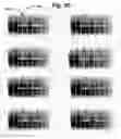 Fig. 07 - Passive MRI-guided tracking of metallic objects using artifact-reduced imaging with selective excitation