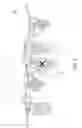Fig. 06 - Head Mounted Display