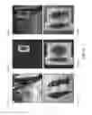 Fig. 16 - Saliency-based object counting and localization