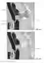 Fig. 06 - Learning-based spine vertebra localization and segmentation in 3D CT