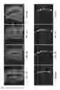 Fig. 07 - Learning-based spine vertebra localization and segmentation in 3D CT
