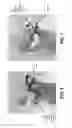 Fig. 07 - Surgeon head-mounted display apparatuses
