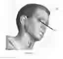 Fig. 05 - ARTIFICIAL EYE SYSTEM COMPRISING A SEE-THROUGH DISPLAY
