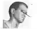 Fig. 01 - Artificial eye system