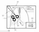 Fig. 01 - SYSTEM AND METHODS FOR TRAINING PHYSICIANS TO PERFORM ABLATION PROCEDURES