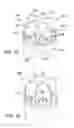 Fig. 09 - Three-dimensional beam forming X-ray source