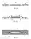Fig. 03 - Leadframe package with side solder ball contact and method of manufacturing
