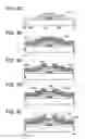 Fig. 05 - Semiconductor device and method for manufacturing the same