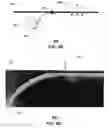 Fig. 07 - Radial antenna and methods for use therewith