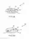 Fig. 08 - System for adjusting magnetic retention force in auditory prostheses