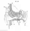 Fig. 02 - Medical device having an impulse force-resistant component