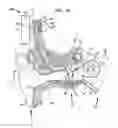 Fig. 03 - Medical device having an impulse force-resistant component