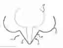 Fig. 01 - Brassiere