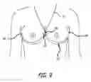 Fig. 06 - Brassiere