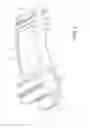 Fig. 03 - Awareness device for athletes